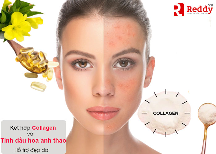 kết hợp Collagen và tinh dầu hoa anh thảo hỗ trợ làm đẹp da
